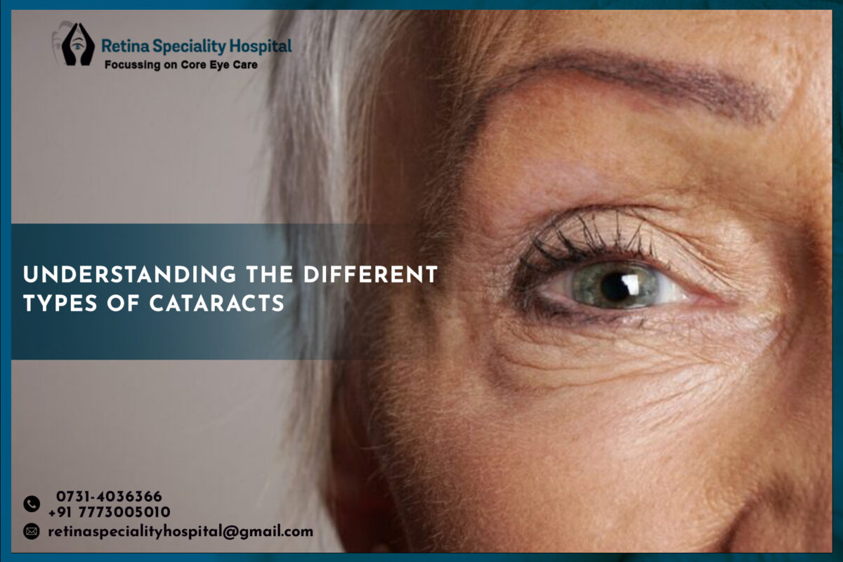 Understanding the different types of Cataracts 