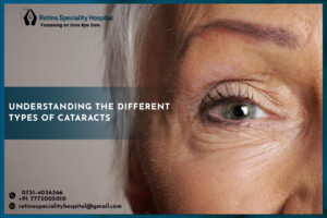 Understanding the different types of Cataracts