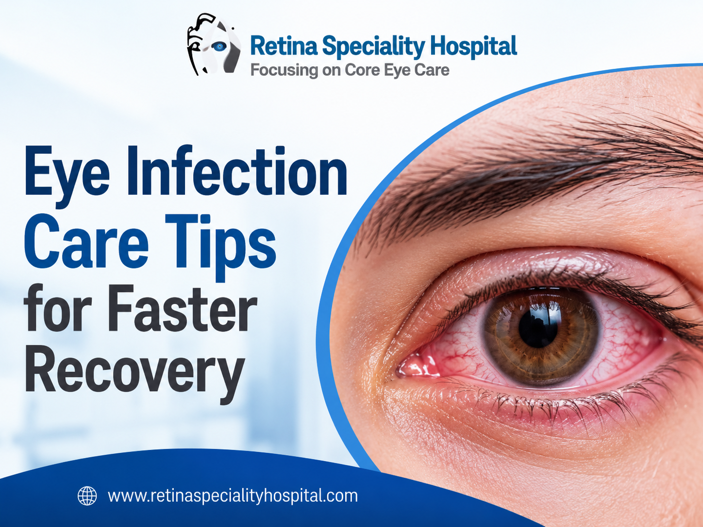 Eye Infection Care Tips for Faster Recovery