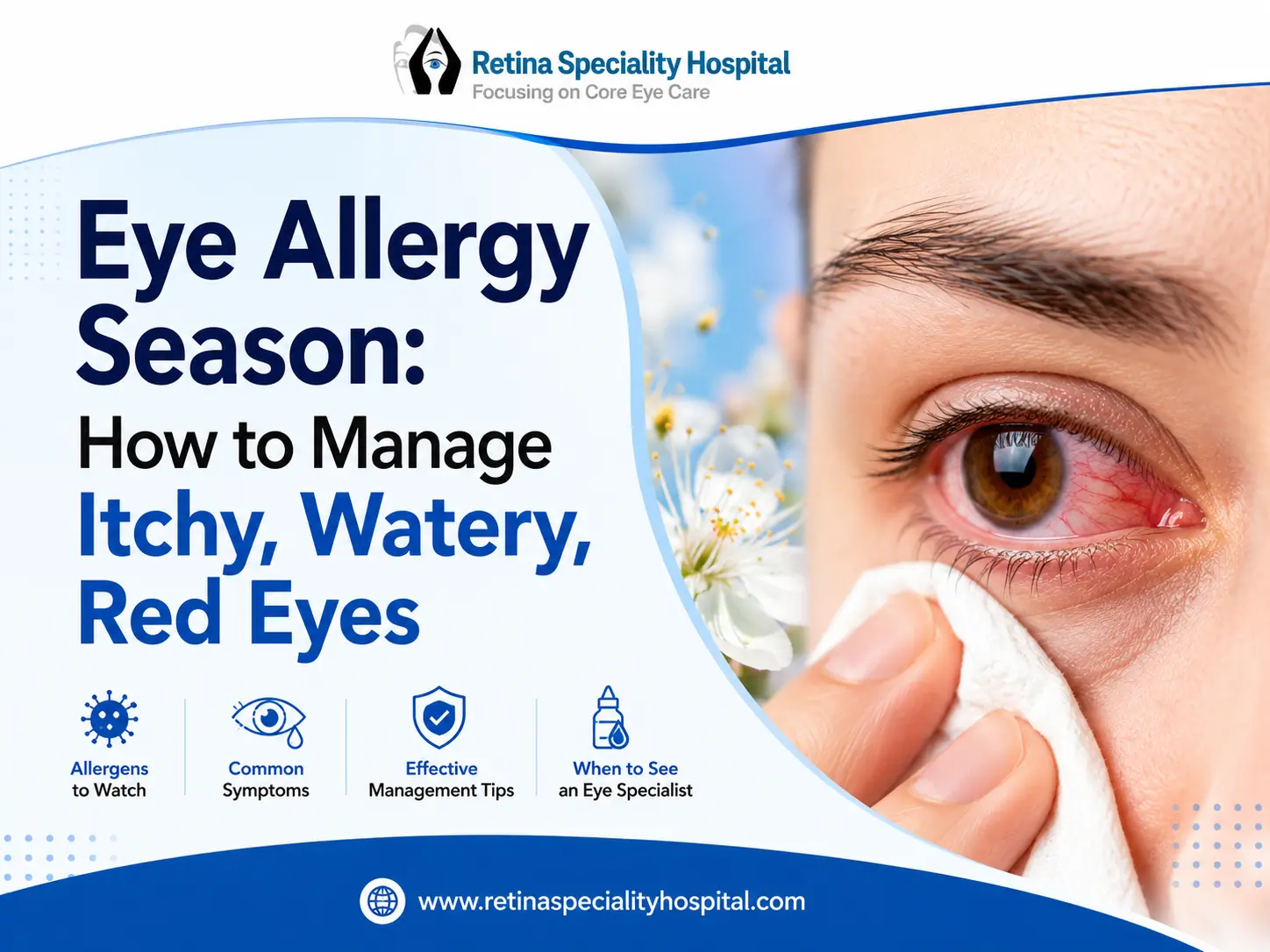 Eye Allergy Season: How to Manage Itchy, Watery, Red Eyes Naturally and Effectively