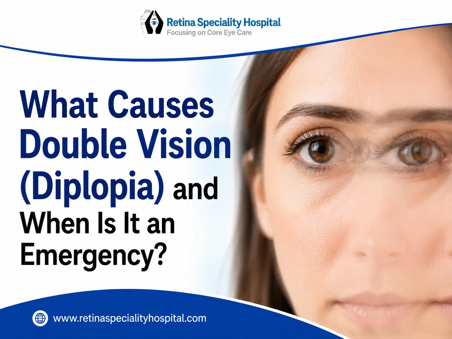 What Causes Double Vision (Diplopia) and When Is It an Emergency?