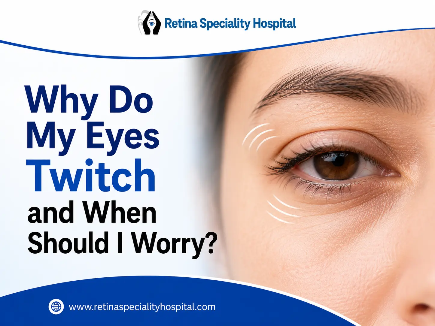 Why Do My Eyes Twitch and When Should I Worry?