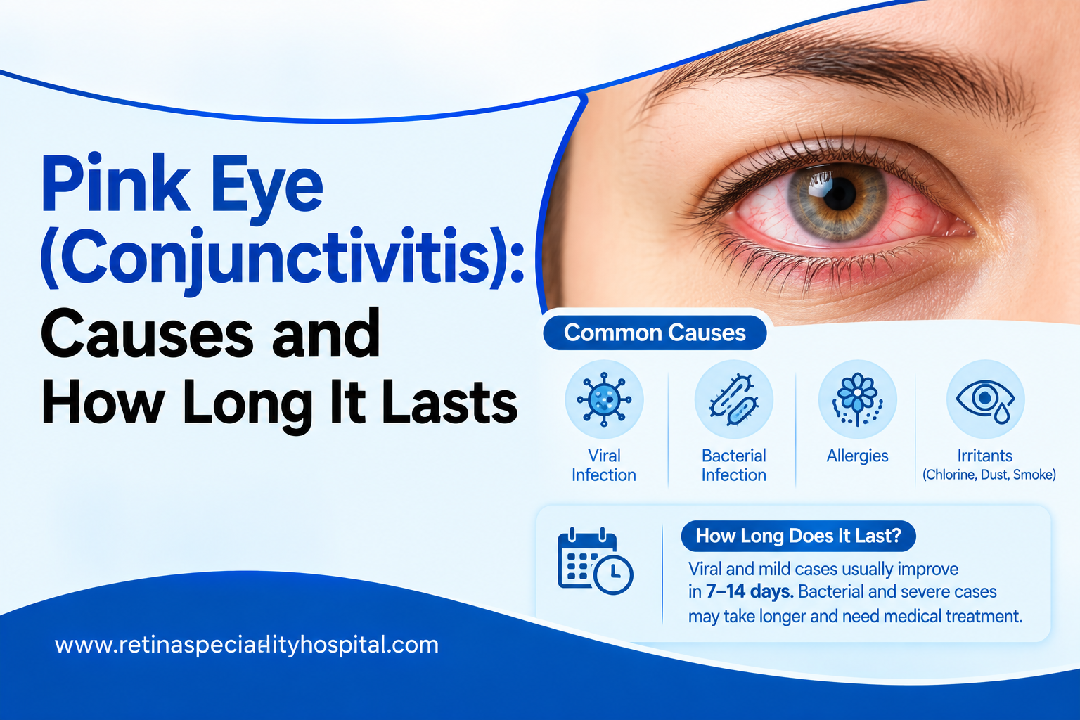 Pink Eye (Conjunctivitis): Causes and How Long It Lasts